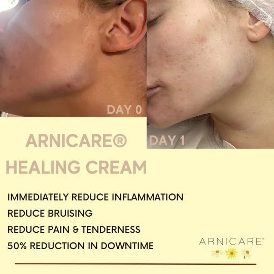 3 Arnicare ingredients that can assist with inflammation