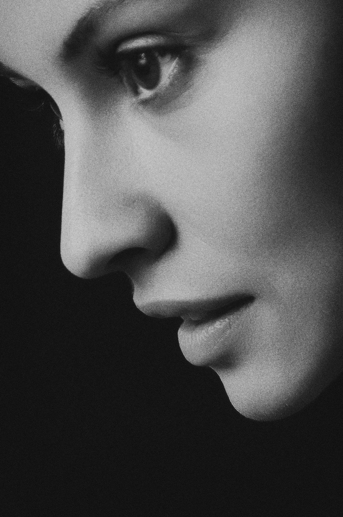Non-Surgical Rhinoplasty: is there an appropriate aftercare?