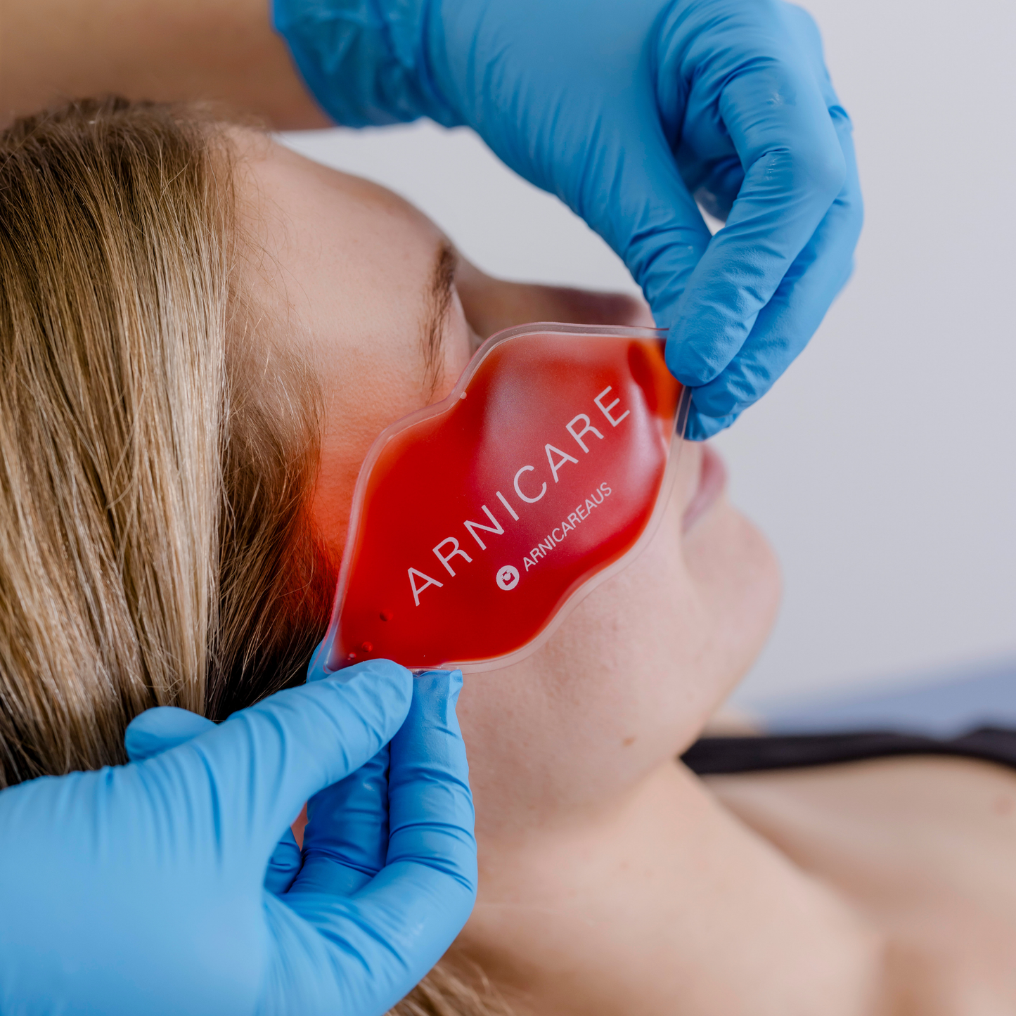 A close-up of a person lying down while blue-gloved hands apply a red ARNICARE lip shaped ice pack to their eye.