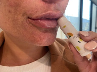 Person holding a arnica lip balm close to their lips with a blurred background