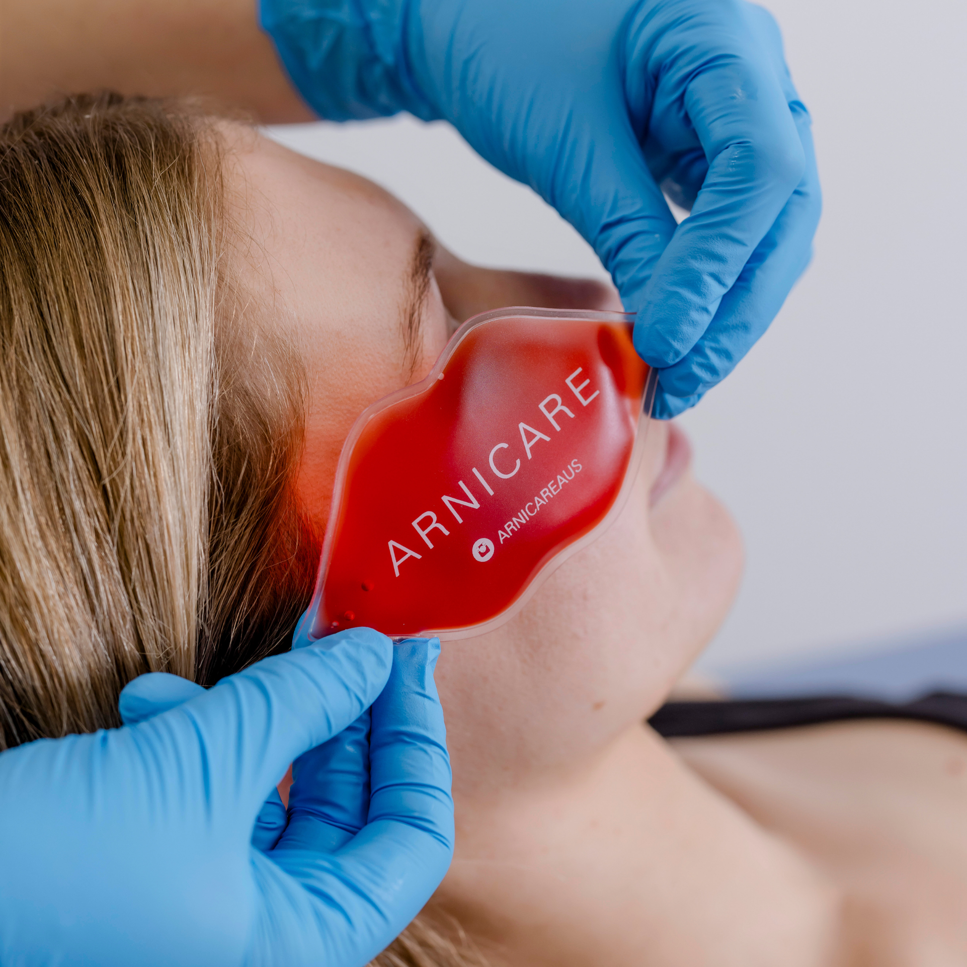 A close-up of a person lying down while blue-gloved hands apply a red ARNICARE lip shaped ice pack to their eye.